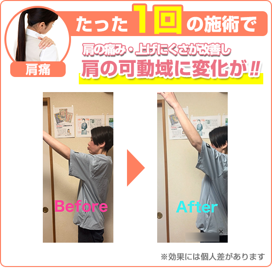 ビフォーアフター